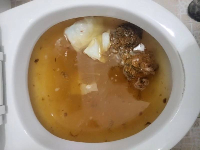 인천 변기막힘 작업사례 4